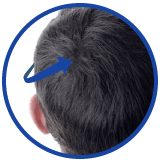 foltina stimola crescita capelli
